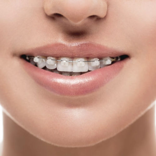 dental-expert-orthodontie-traitement-dentiste-soins-dentaires