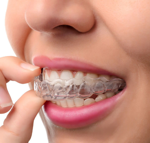 orthodontie-dental-expert-clinique-dentaire-dentiste-traitement